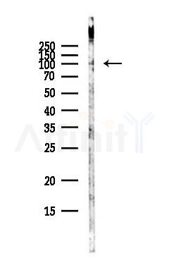 RAPGEF3 Antibody - Western blot analysis of lysates from HepG2 cells(heat-shock,45min treatment), using RAPGEF3 Antibody at 1/1000 dilution.