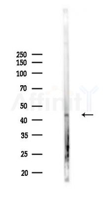 RASSF6 Antibody - Western blot analysis of lysates from B16F10-LUC cells(starvation,24h treatment), using RASSF6 Antibody at 1/1000 dilution.