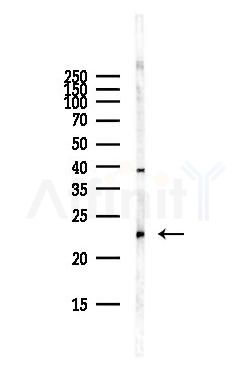 RAB6A Antibody - Western blot analysis of lysates from Hela cells(starvation,24h treatment), using RAB6A Antibody at 1/1000 dilution.