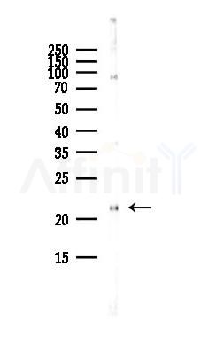 RAB6A Antibody - Western blot analysis of lysates from HepG2 cells(heat-shock,45min treatment), using RAB6A Antibody at 1/1000 dilution.