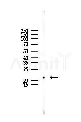 RAB6A Antibody - Western blot analysis of lysates from Rat liver, using RAB6A Antibody at 1/1000 dilution.