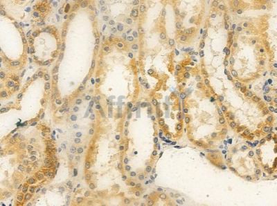 RAB6C Antibody - DF4408 at 1/100 staining human normal kidney tissue by IHC-P.