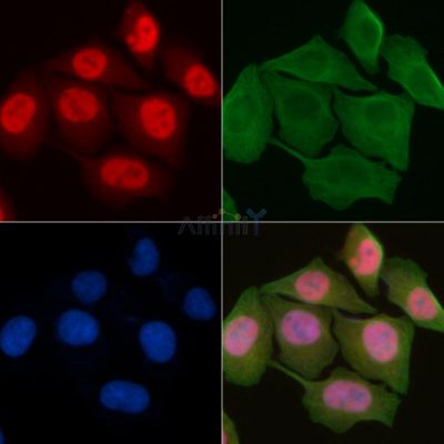 RAB7L1 Antibody - DF4409 staining Hela cells by IF/ICC.