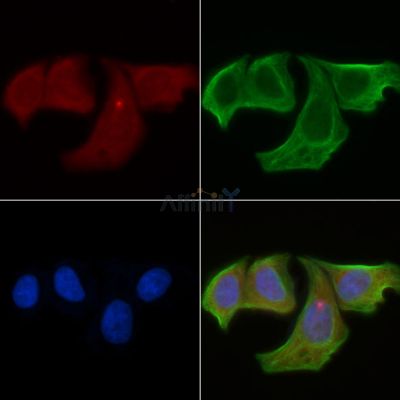 ARHGEF12 Antibody - DF4432 staining Hela cells(30min of UV treatment) by IF/ICC.