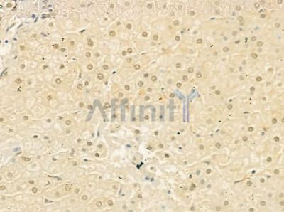 ARHGEF5 Antibody - DF4435 at 1/100 staining human normal liver tissue by IHC-P.