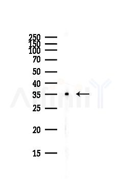 SCAMP1 Antibody - Western blot analysis of lysates from Hela cells(starvation,24h treatment), using SCAMP1 Antibody at 1/1000 dilution.