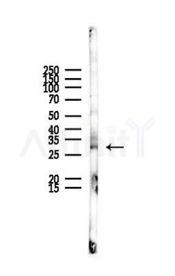 SCAMP1 Antibody - Western blot analysis of lysates from Rat liver, using SCAMP1 Antibody at 1/1000 dilution.