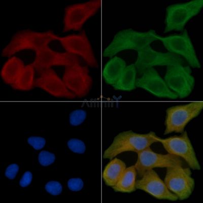 DVL3 Antibody - DF4455 staining Hela cells by IF/ICC.