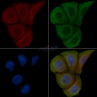STK32C Antibody - DF4464 staining Hela cells(45min of heat-shock) by IF/ICC.