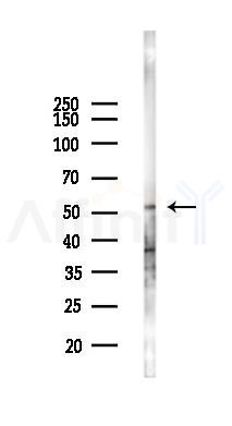 PPP2R3C Antibody - Western blot analysis of lysates from 293 cells(UV,30min treatment), using PPP2R3C Antibody at 1/1000 dilution.