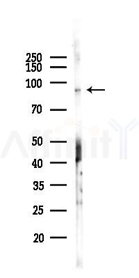 SH3RF3 Antibody - Western blot analysis of lysates from 293 cells(UV,30min treatment), using SH3RF3 Antibody at 1/1000 dilution.