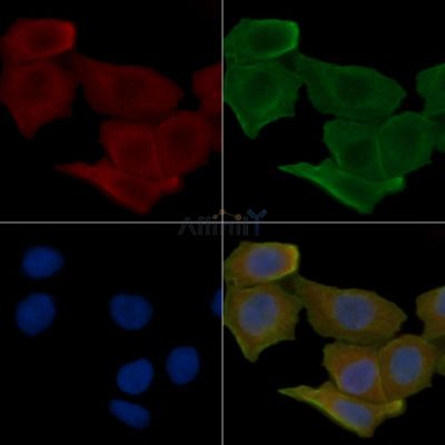 SIRPB1 Antibody - DF4507 staining Hela cells(30min of UV treatment) by IF/ICC.