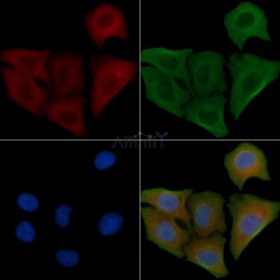 SLC4A11 Antibody - DF4511 staining Hela cells by IF/ICC.