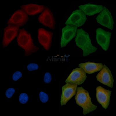 SLC9A9 Antibody - DF4520 staining Hela cells by IF/ICC.