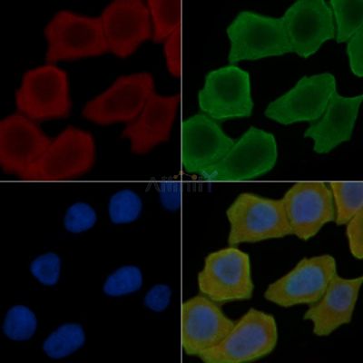 SLC24A1 Antibody - DF4523 staining Hela cells(30min of UV treatment) by IF/ICC.