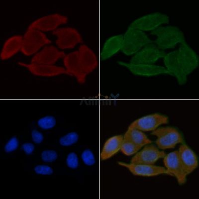 SLC24A3 Antibody - DF4524 staining Hela cells(30min of UV treatment) by IF/ICC.