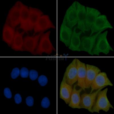 SOS2 Antibody - DF4535 staining Hela cells(45min of heat-shock) by IF/ICC.