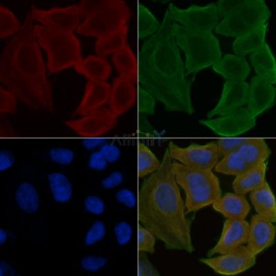 SYT13 Antibody - DF4553 staining Hela cells(30min of UV treatment) by IF/ICC.