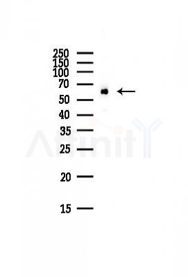 CCT8 Antibody - Western blot analysis of lysates from Hela cells(starvation,24h treatment), using CCT8 Antibody at 1/1000 dilution.