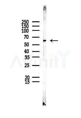 CCT8 Antibody - Western blot analysis of lysates from PC12 cells, using CCT8 Antibody at 1/1000 dilution.