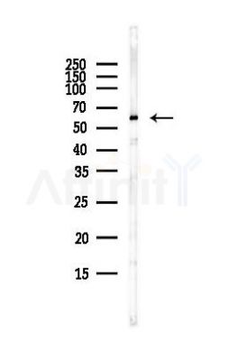 CCT8 Antibody - Western blot analysis of lysates from HUVEC cells(starvation,24h treatment), using CCT8 Antibody at 1/1000 dilution.