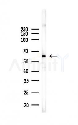 CCT8 Antibody - Western blot analysis of lysates from Mouse liver, using CCT8 Antibody at 1/1000 dilution.