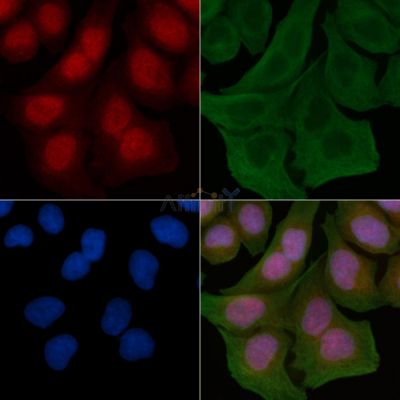 GTF3A Antibody - DF4574 staining Hela cells by IF/ICC.