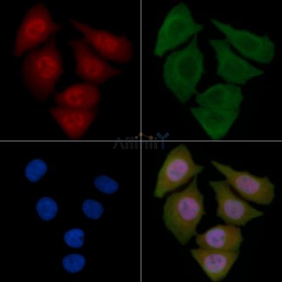 USP45 Antibody - DF4595 staining Hela cells by IF/ICC.