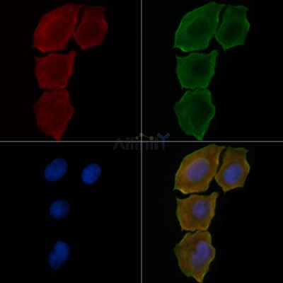 VTI1A Antibody - DF4609 staining Hela cells(30min of UV treatment) by IF/ICC.