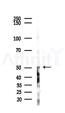 ZFYVE19 Antibody - Western blot analysis of lysates from 293 cells(UV,30min treatment), using ZFYVE19 Antibody at 1/1000 dilution.