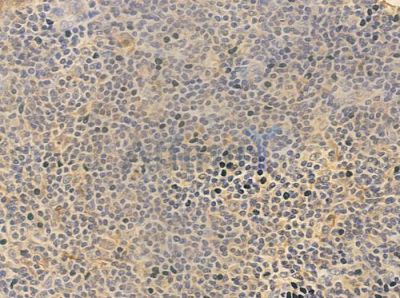 CA181 Antibody - DF4643 at 1/100 staining human normal tonsil tissue by IHC-P.