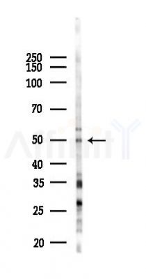 Rad51C Antibody - Western blot analysis of lysates from EC304 cells(UV,30min treatment), using Rad51C Antibody at 1/1000 dilution.