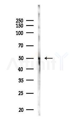 IKZF2 Antibody - Western blot analysis of lysates from COLO205 cells(heat-shock,45min treatment), using IKZF2 Antibody at 1/1000 dilution.