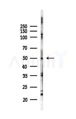 IKZF2 Antibody - Western blot analysis of lysates from A375 cells(heat-shock,45min treatment), using IKZF2 Antibody at 1/1000 dilution.