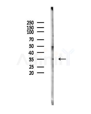 MED27 Antibody - Western blot analysis of lysates from Hela cells(heat-shock,45min treatment), using MED27 Antibody at 1/1000 dilution.