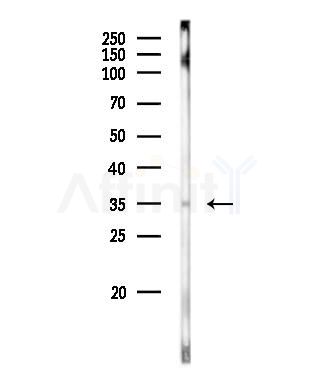 MED27 Antibody - Western blot analysis of lysates from PC12 cells, using MED27 Antibody at 1/1000 dilution.