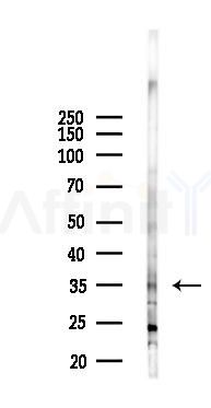 MED27 Antibody - Western blot analysis of lysates from B16F10-LUC cells(starvation,24h treatment), using MED27 Antibody at 1/1000 dilution.