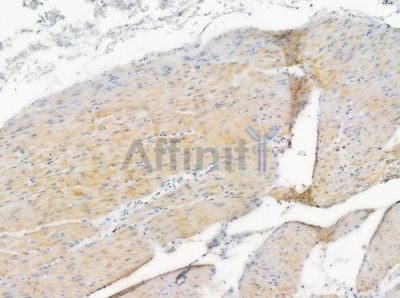 LIPB1 Antibody - DF4665 at 1/100 staining human normal gastric tissue by IHC-P.
