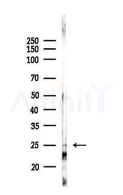 FEV Antibody - Western blot analysis of lysates from A375 cells(heat-shock,45min treatment), using FEV Antibody at 1/1000 dilution.