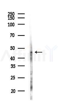 BRE Antibody - Western blot analysis of lysates from EC304 cells(UV,30min treatment), using BRE Antibody at 1/1000 dilution.