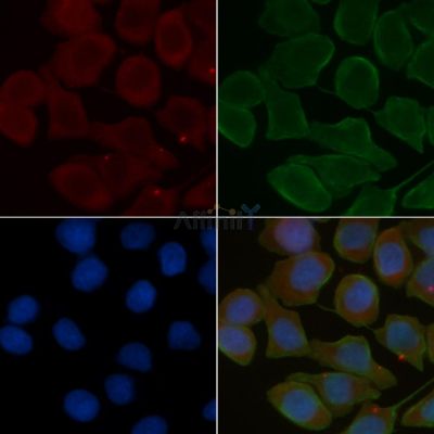 FGRL1 Antibody - DF4701 staining Hela cells(30min of UV treatment) by IF/ICC.