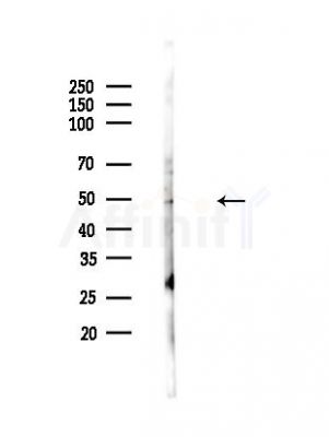 HBAP1 Antibody - Western blot analysis of lysates from PC12 cells, using HBAP1 Antibody at 1/1000 dilution.