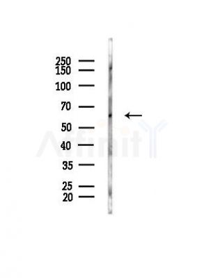 IGF2BP2 Antibody - Western blot analysis of lysates from Hela cells(heat-shock, 45min treatment), using IGF2BP2 Antibody at 1/1000 dilution.