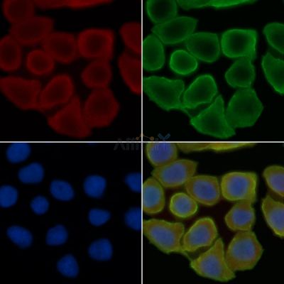 KRT37/38 Antibody - DF4714 staining Hela cells(30min of UV treatment) by IF/ICC.