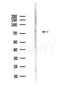 MX2 Antibody - Western blot analysis of lysates from HUVEC cells(LPS,4h treatment), using MX2 Antibody at 1/1000 dilution.