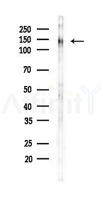 SNIP Antibody - Western blot analysis of lysates from Rat brain, using SNIP Antibody at 1/1000 dilution.