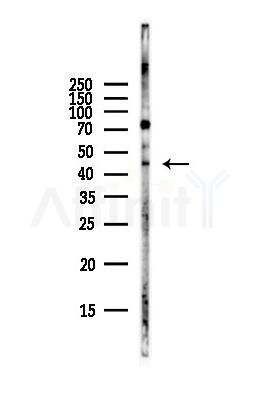 GATA6 Antibody - Western blot analysis of lysates from Hela cells(starvation,24h treatment), using GATA6 Antibody at 1/1000 dilution.