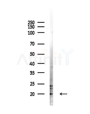 BCL7A Antibody - Western blot analysis of lysates from Mouse liver, using BCL7A Antibody at 1/1000 dilution.