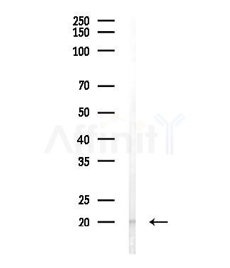 BCL7A Antibody - Western blot analysis of lysates from COLO205 cells(LPS,4h treatment), using BCL7A Antibody at 1/1000 dilution.