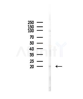 BCL7A Antibody - Western blot analysis of lysates from Hela cells(heat-shock,45min treatment), using BCL7A Antibody at 1/1000 dilution.